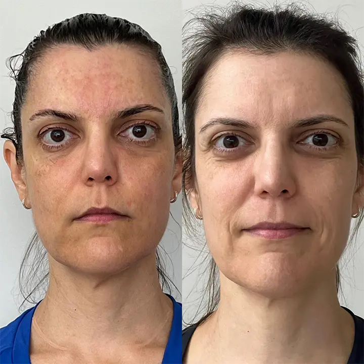 AnyConv.com__Skinbooster1