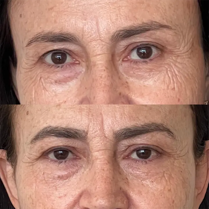 AnyConv.com__Skinbooster2