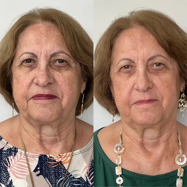 AnyConv.com__Skinbooster3