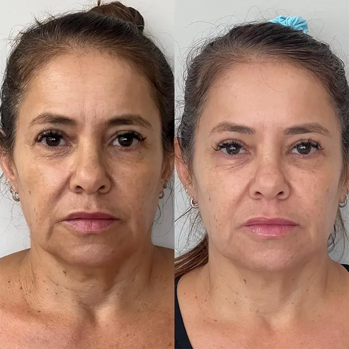 AnyConv.com__Skinbooster6