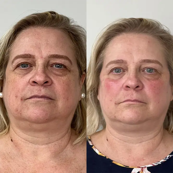 AnyConv.com__Skinbooster8