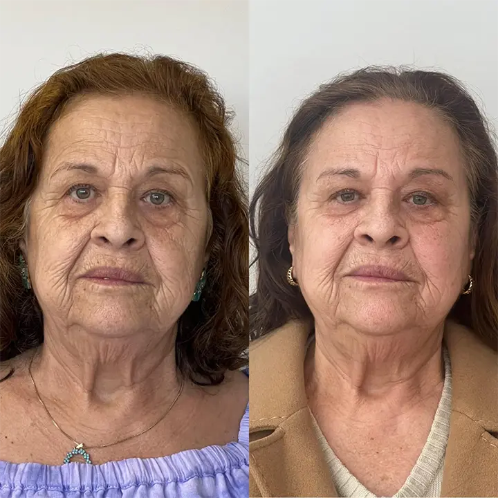 AnyConv.com__Skinbooster9