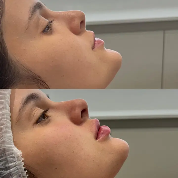 AnyConv.com__labial2