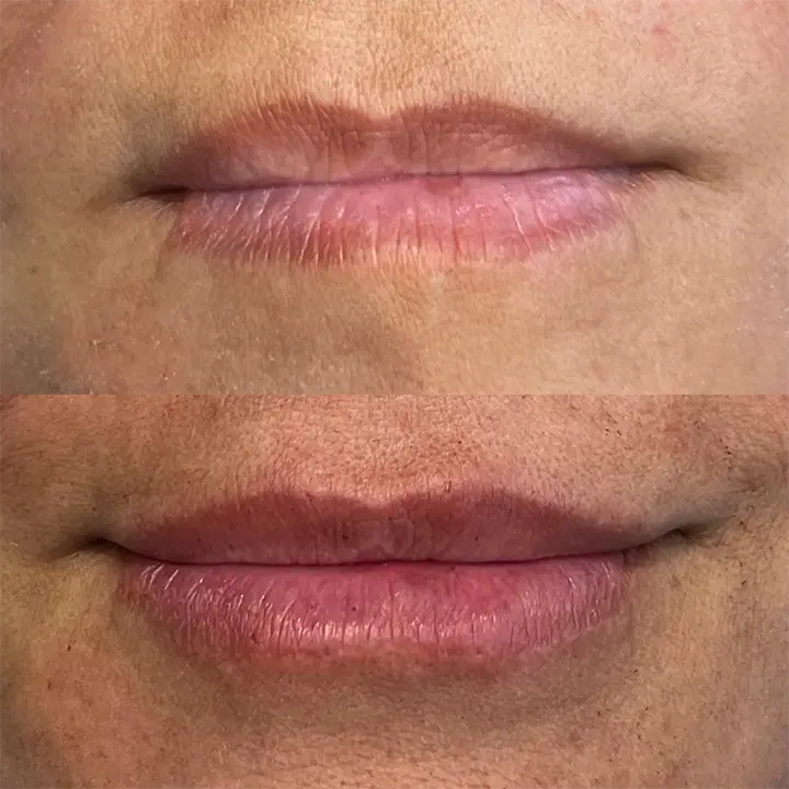 AnyConv.com__labial3