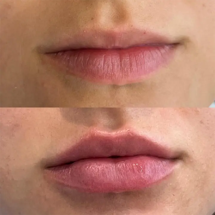 AnyConv.com__labial4