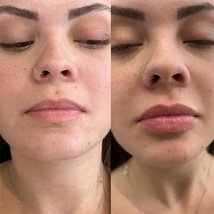 AnyConv.com__labial5