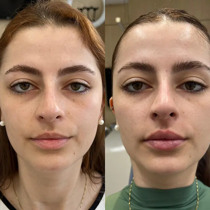 AnyConv.com__labial6