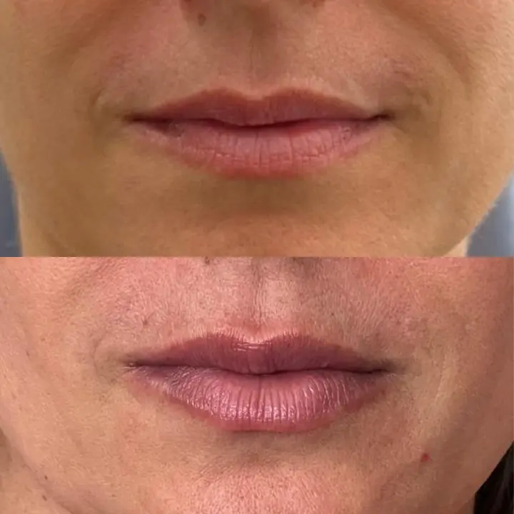 AnyConv.com__labial7