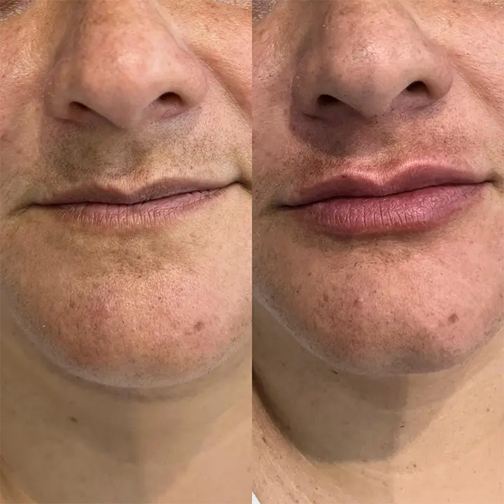 AnyConv.com__labial8