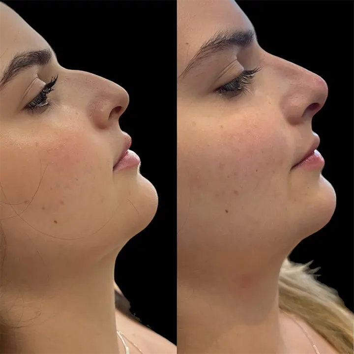 AnyConv.com__preenchimento1