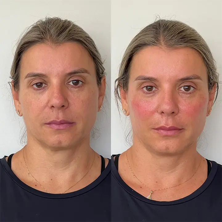 AnyConv.com__preenchimento10