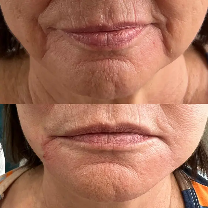 AnyConv.com__preenchimento2