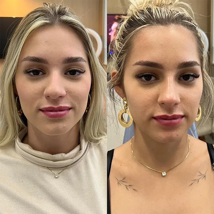 AnyConv.com__preenchimento3