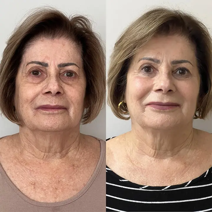 AnyConv.com__preenchimento4