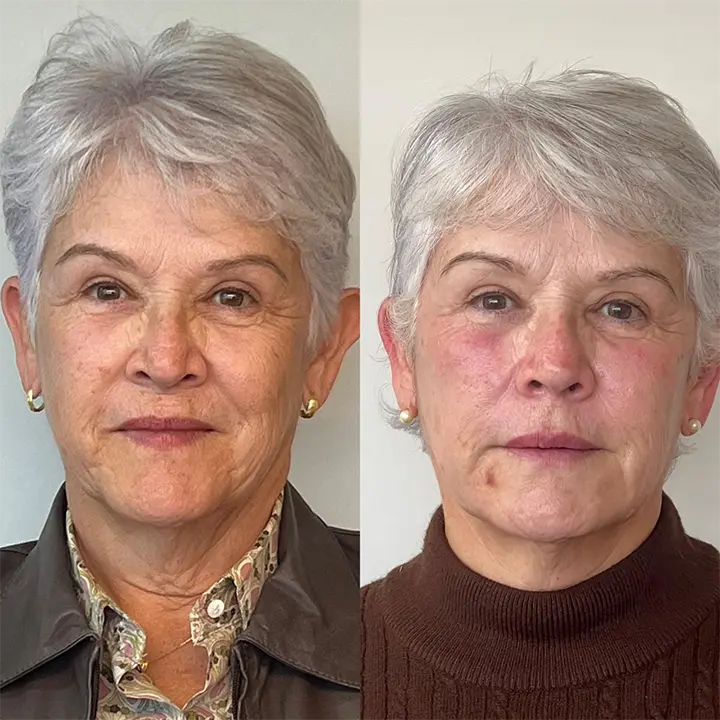 AnyConv.com__preenchimento5