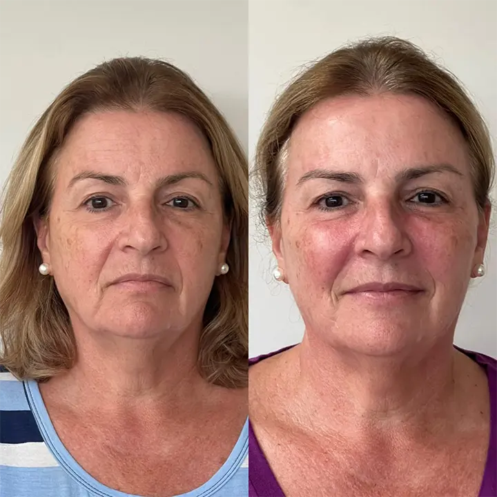 AnyConv.com__preenchimento6