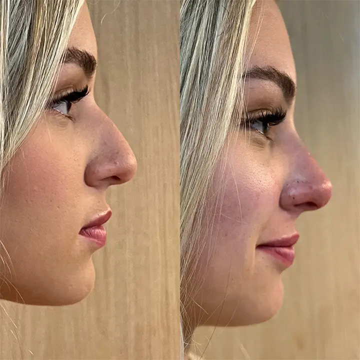 AnyConv.com__preenchimento7