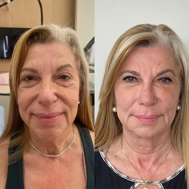 AnyConv.com__preenchimento8