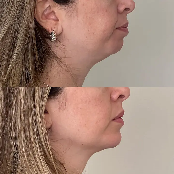 AnyConv.com__preenchimento9